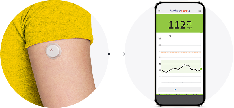 A close-up of the back of someone’s arm wearing a FreeStyle Libre sensor with an arrow pointing to a phone displayng the FreeStyle Libre app.