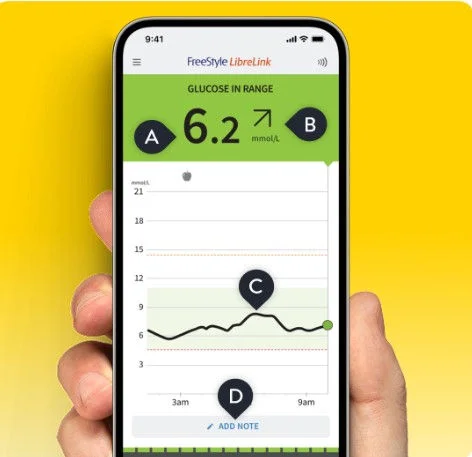 A phone displaying the FreeStyle Libre app displaying four markers: A, B, C, and D showing different real time glucose monitoring information.