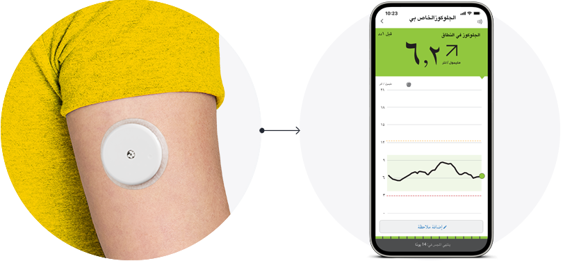 A close-up of the back of someone’s arm wearing a FreeStyle Libre sensor with an arrow pointing to a phone displayng the FreeStyle Libre app.