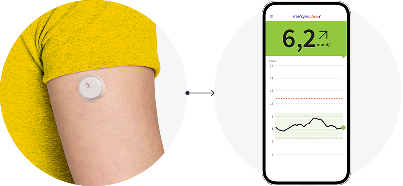 Sensor på arm viser data på telefon