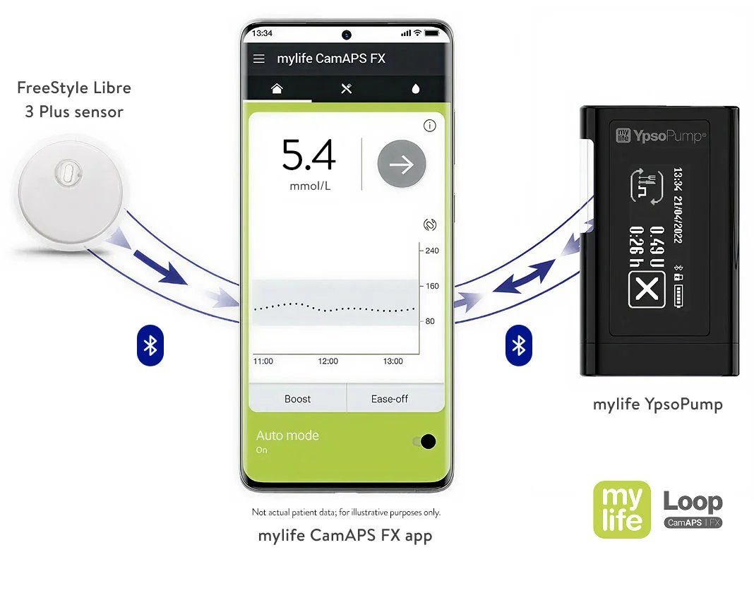 FSL3 Sensor, mylife CamAPS FX app, and mylife YpsoPump