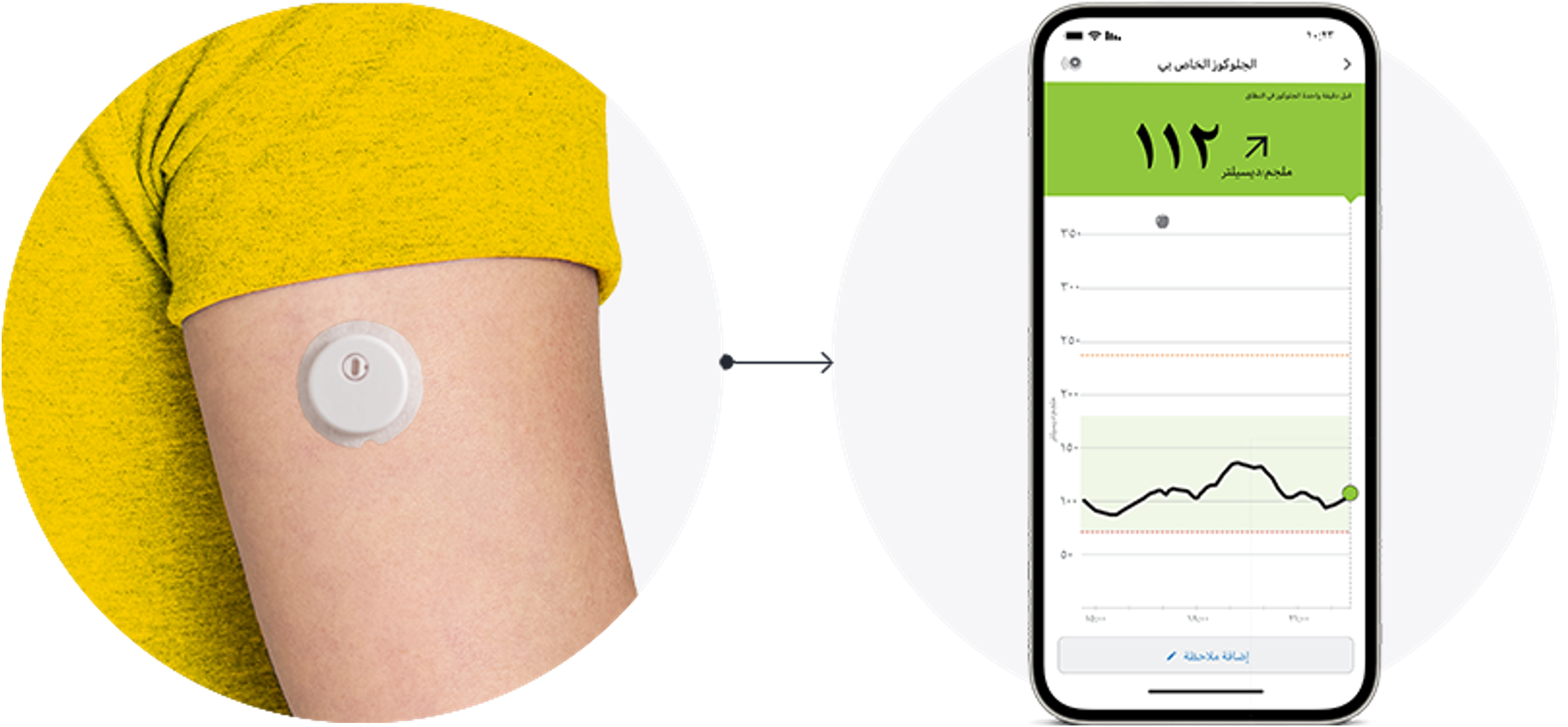 A close-up of the back of someone’s arm wearing a FreeStyle Libre sensor with an arrow pointing to a phone displayng the FreeStyle Libre app.