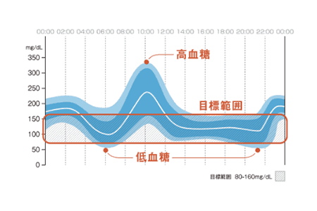 AGP（Ambulatory Glucose Profile）とは、連続して測定・記録された血糖値や間質液中グルコース値を集約し、その傾向を視覚的に把握しやすくしてくれる解析方法です。