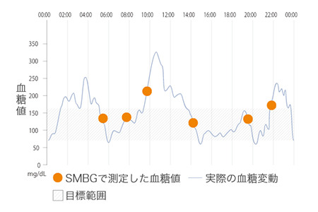 FreeStyleリブレは、血糖の推移や変動パターンを簡単に知ることができるグルコース測定器です。