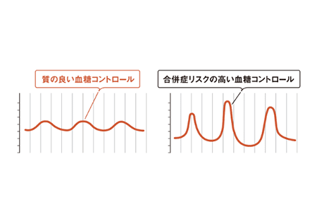 糖尿病のさまざまな合併症を防ぐため、血糖値がどのように変動しているか、つまり「血糖トレンド」に注目することが重要とされています。血糖トレンドについて詳しくみることができると、下記のような点に関し、ご自身の状態が確認しやすくなります。