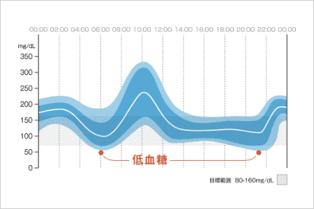 AGP（Ambulatory Glucose Profile）とは、連続して測定・記録された血糖値や間質液中グルコース値を集約し、その傾向を視覚的に把握しやすくしてくれる解析方法です。