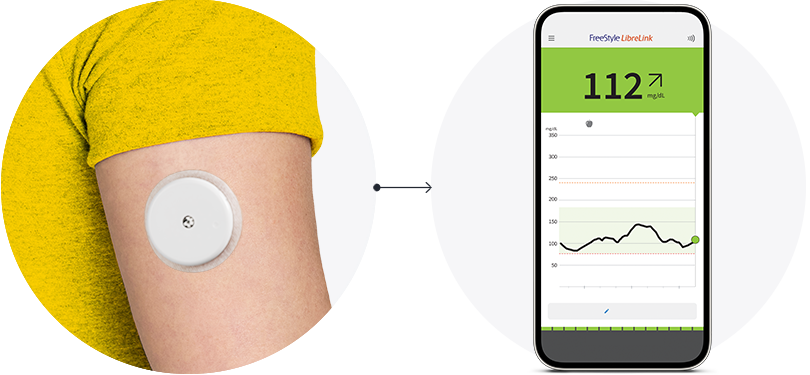 A close-up of the back of someone’s arm wearing a FreeStyle Libre sensor with an arrow pointing to a phone displayng the FreeStyle Libre app.