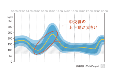 AGP（Ambulatory Glucose Profile）とは、連続して測定・記録された血糖値や間質液中グルコース値を集約し、その傾向を視覚的に把握しやすくしてくれる解析方法です。