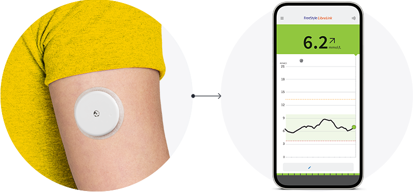 A close-up of the back of someone’s arm wearing a FreeStyle Libre sensor with an arrow pointing to a phone displayng the FreeStyle Libre app.