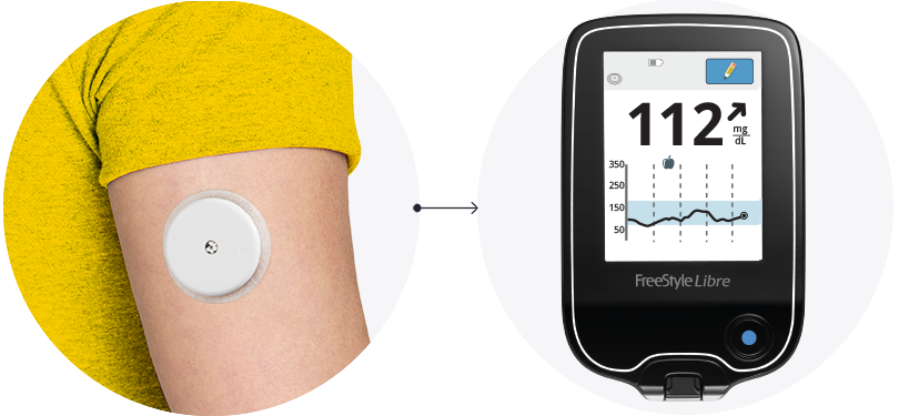 A close-up of the back of someone’s arm wearing a FreeStyle Libre sensor with an arrow pointing to a phone displayng the FreeStyle Libre app.