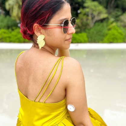 Lady in dress wearing FreeStyle Libre sensor overlooking her right shoulder