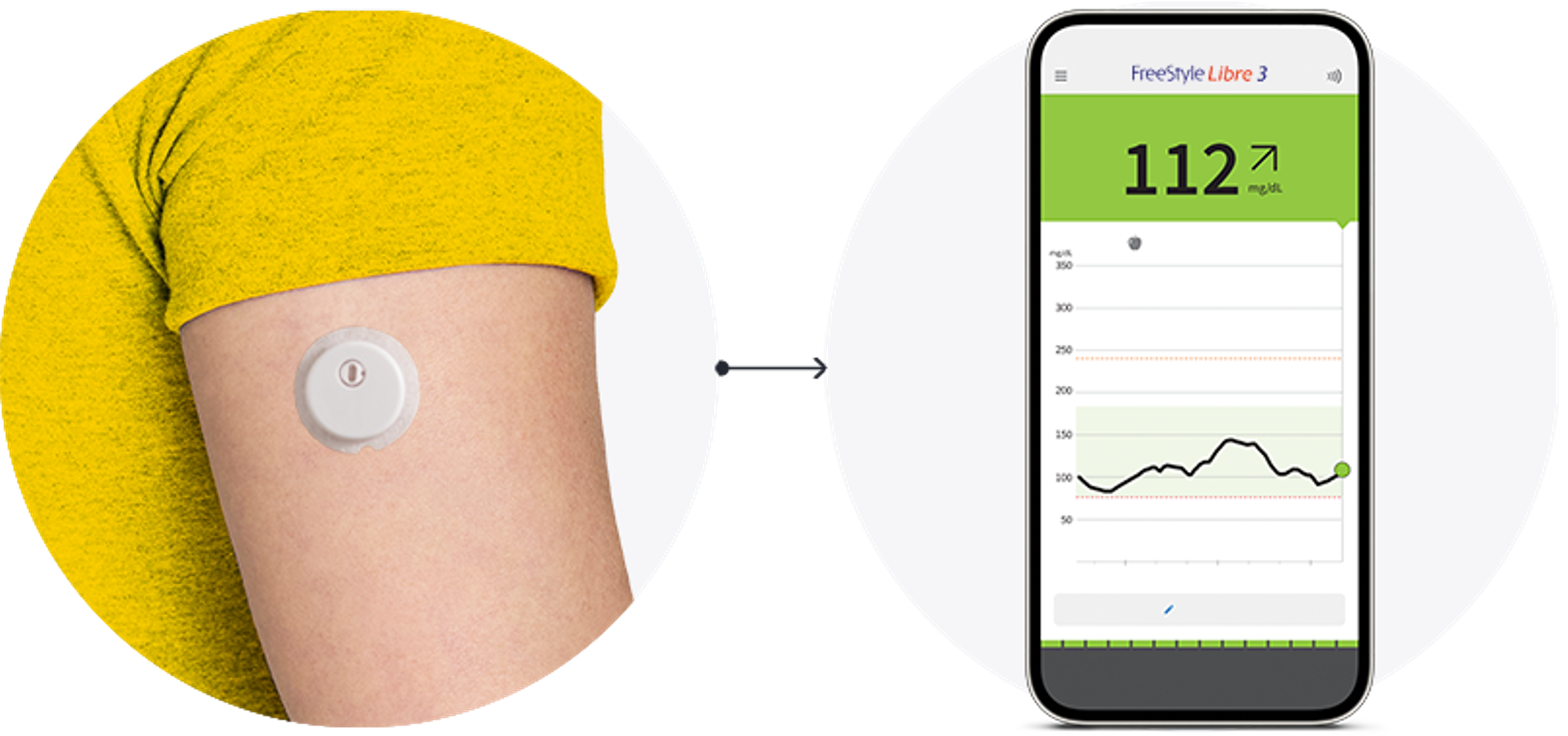 A close-up of the back of someone’s arm wearing a FreeStyle Libre sensor with an arrow pointing to a phone displayng the FreeStyle Libre app.