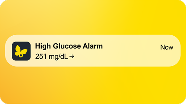 High Glucose Alarm