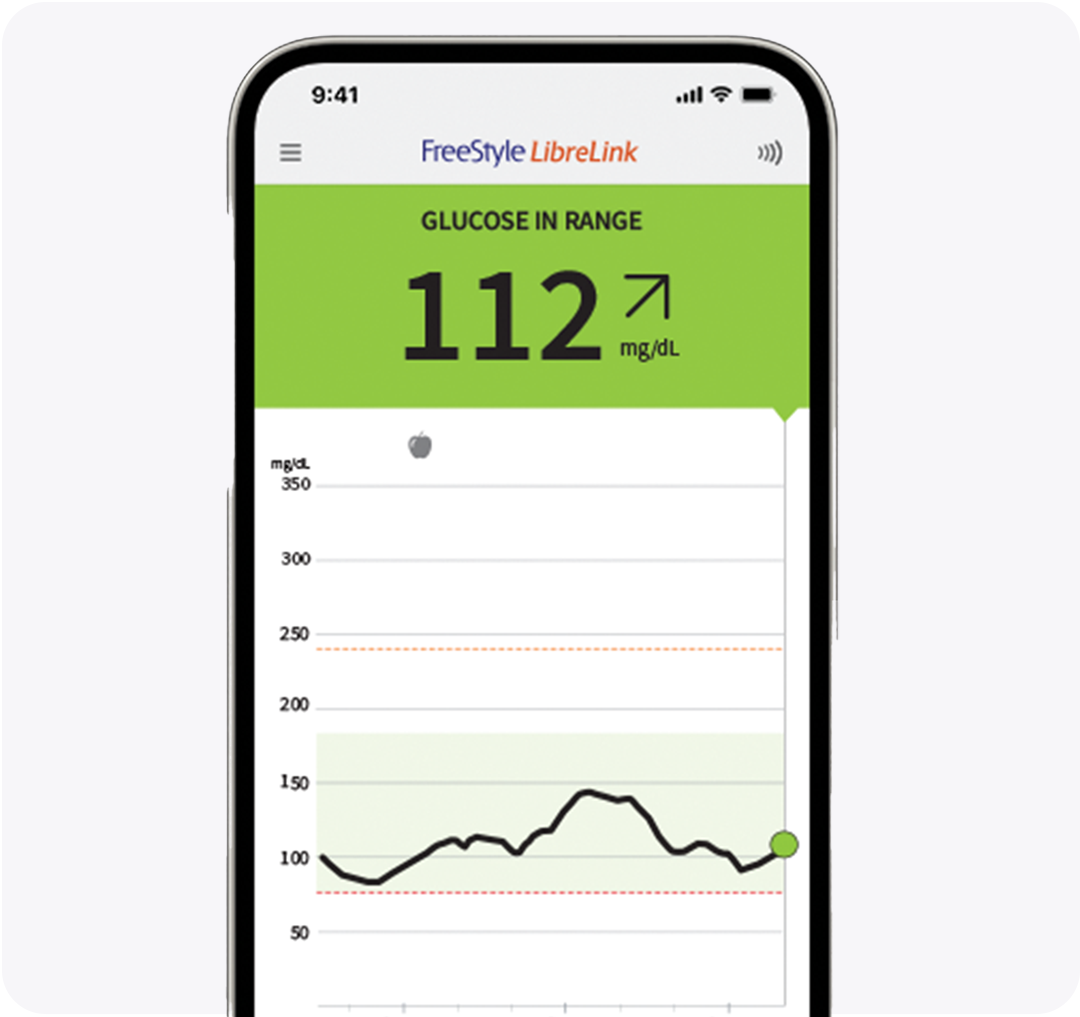 A woman wearing a sensor showing her glucose data on her phone with her husband.