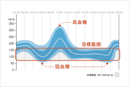 AGP（Ambulatory Glucose Profile）とは、連続して測定・記録された血糖値や間質液中グルコース値を集約し、その傾向を視覚的に把握しやすくしてくれる解析方法です。