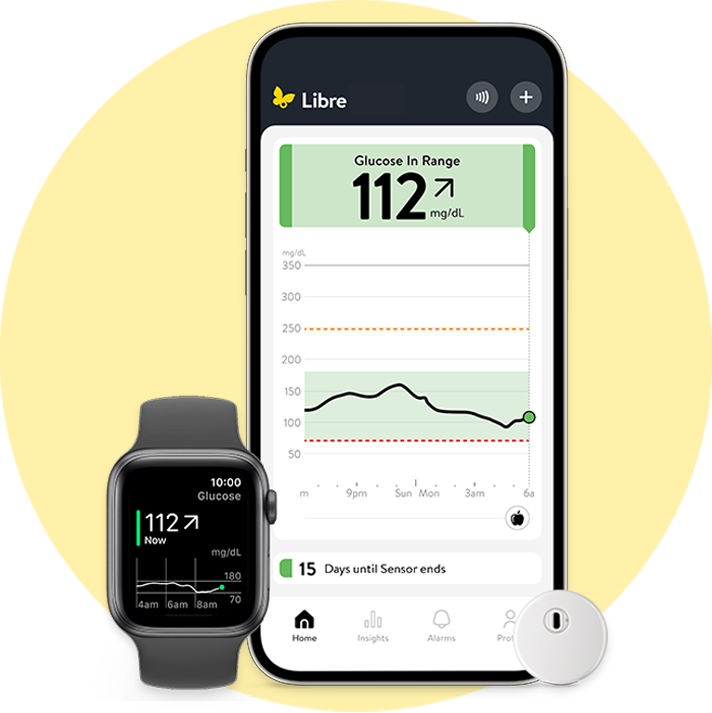 Smartphone, smartwatch, and wearable glucose sensor displaying glucose readings and trend data from a continuous glucose monitoring app.