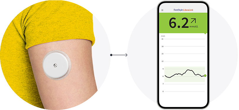 A close-up of the back of someone’s arm wearing a FreeStyle Libre sensor with an arrow pointing to a phone displayng the FreeStyle Libre app.
