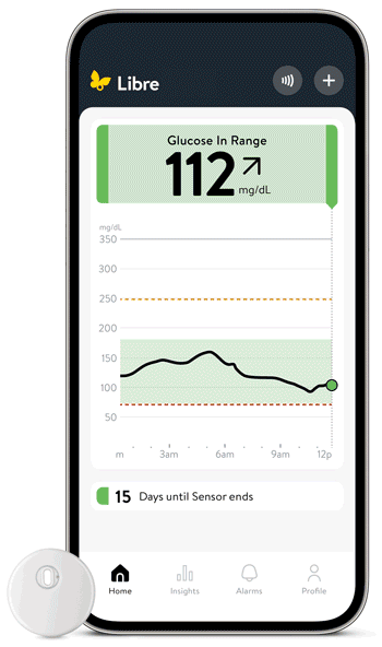 Libre Assist predicting the impact of food’s potential glucose impact