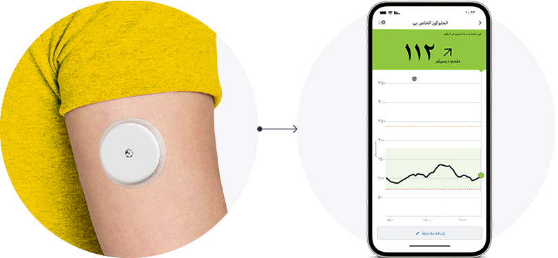 A close-up of the back of someone’s arm wearing a FreeStyle Libre sensor with an arrow pointing to a phone displayng the FreeStyle Libre app.