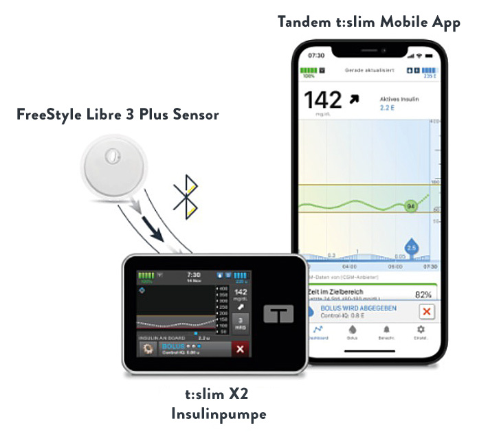 FreeStyle Libre 3 Sensor und AID-System von Tandem