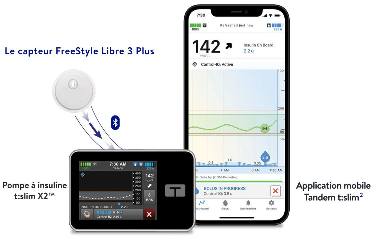 Capteur de glucose en continu FreeStyle Libre 3 Plus et système d'administration automatisée d'insuline Tandem