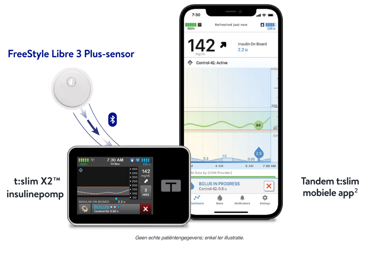 FreeStyle Libre 3 Plus continue glucosesensor en Tandem geautomatiseerd insulinetoedieningssysteem