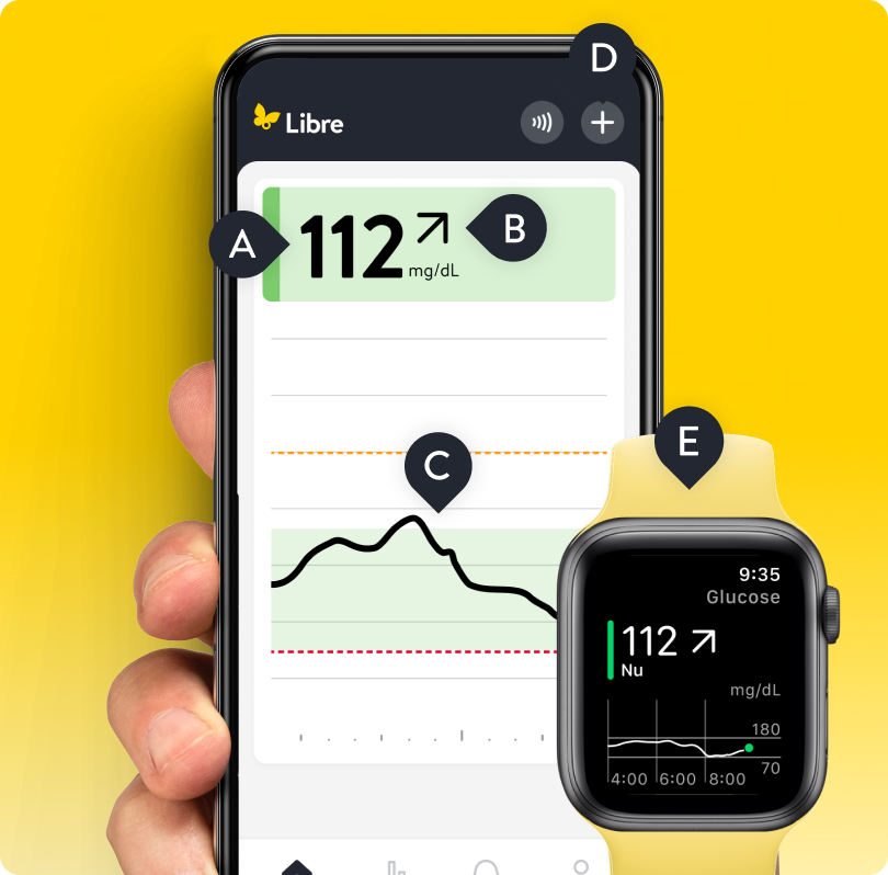 Smartwatch en screenshot van de Libre-app met realtime glucose-informatie
