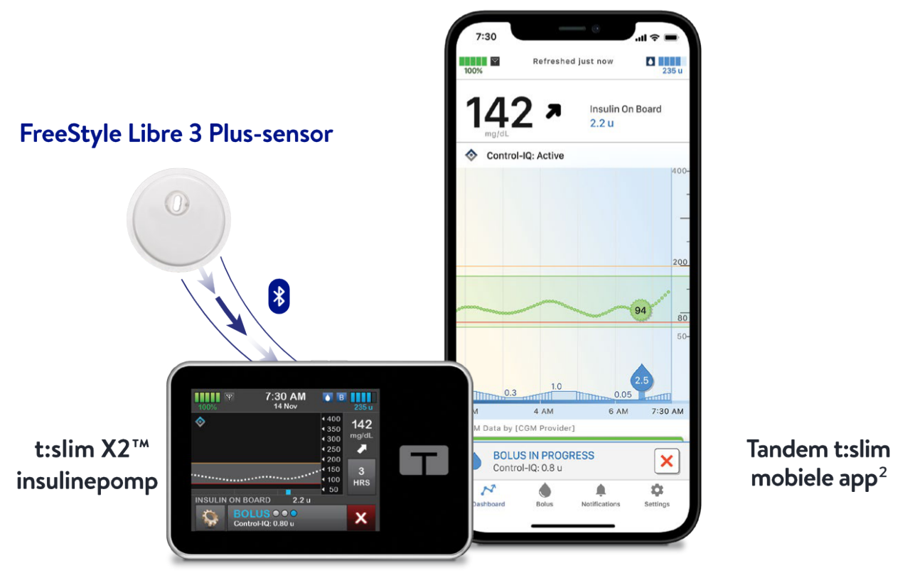 FreeStyle Libre 3 Plus continue glucosesensor en Tandem geautomatiseerd insulinetoedieningssysteem