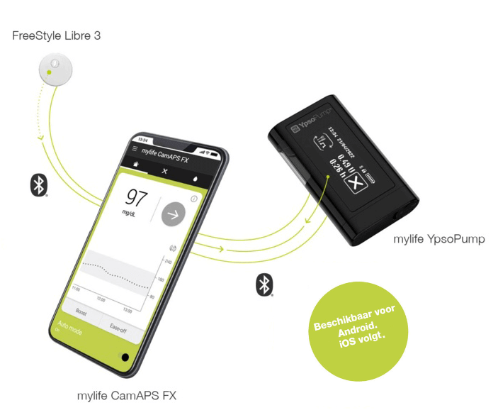 mylife loop systeem