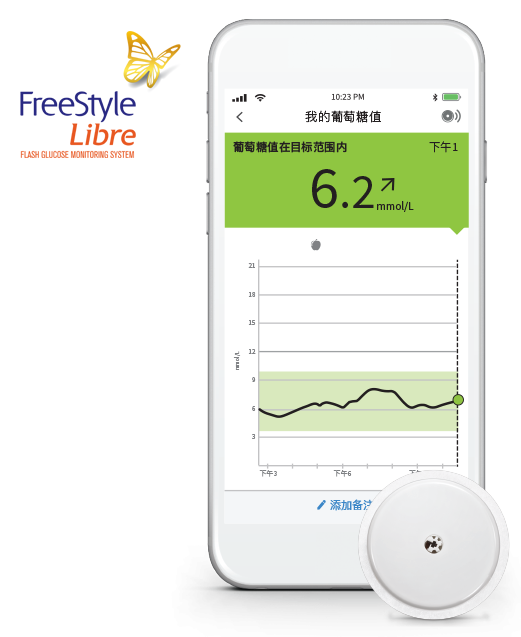 辅理善瞬感（FreeStyle Libre）扫描式葡萄糖监测系统