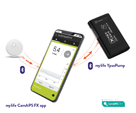 Der FreeStyle Libre 3 Sensor und das myLoop System zur automatisierten Insulinabgabe