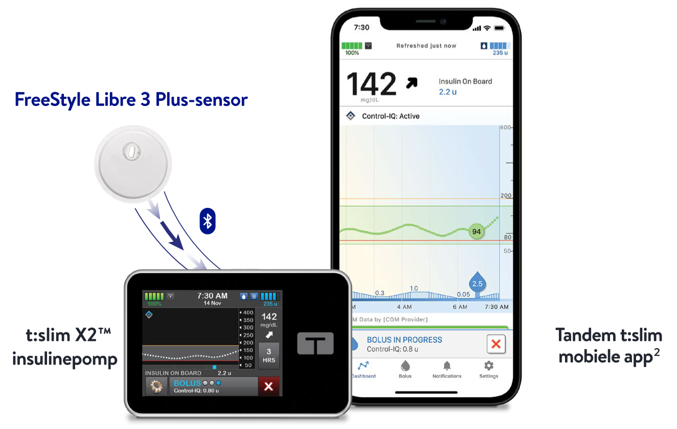 FreeStyle Libre 3 Plus continue glucosesensor en Tandem geautomatiseerd insulinetoedieningssysteem