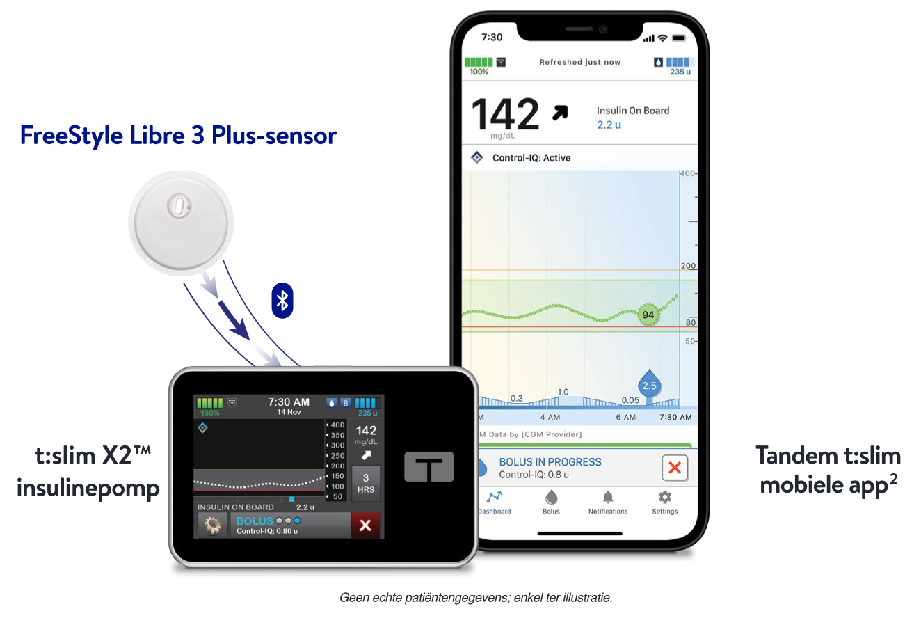 FreeStyle Libre 3 Plus continue glucosesensor en Tandem geautomatiseerd insulinetoedieningssysteem