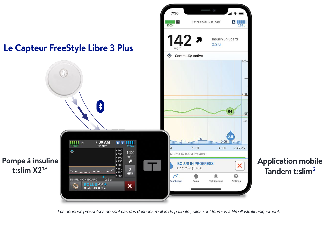 Capteur de glucose en continu FreeStyle Libre 3 Plus et système d’administration automatisée d’insuline Tandem.