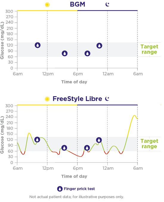 Two charts illustrating how much data is missed when a person measures their glucose levels using BGM versus CGM