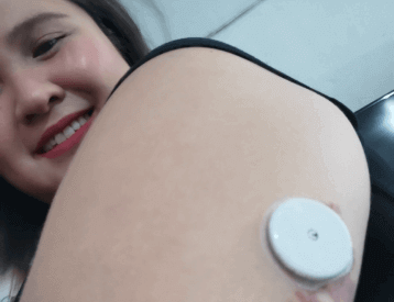 A young woman shows the Freestyle Libre sensor she is wearing, to the camera.