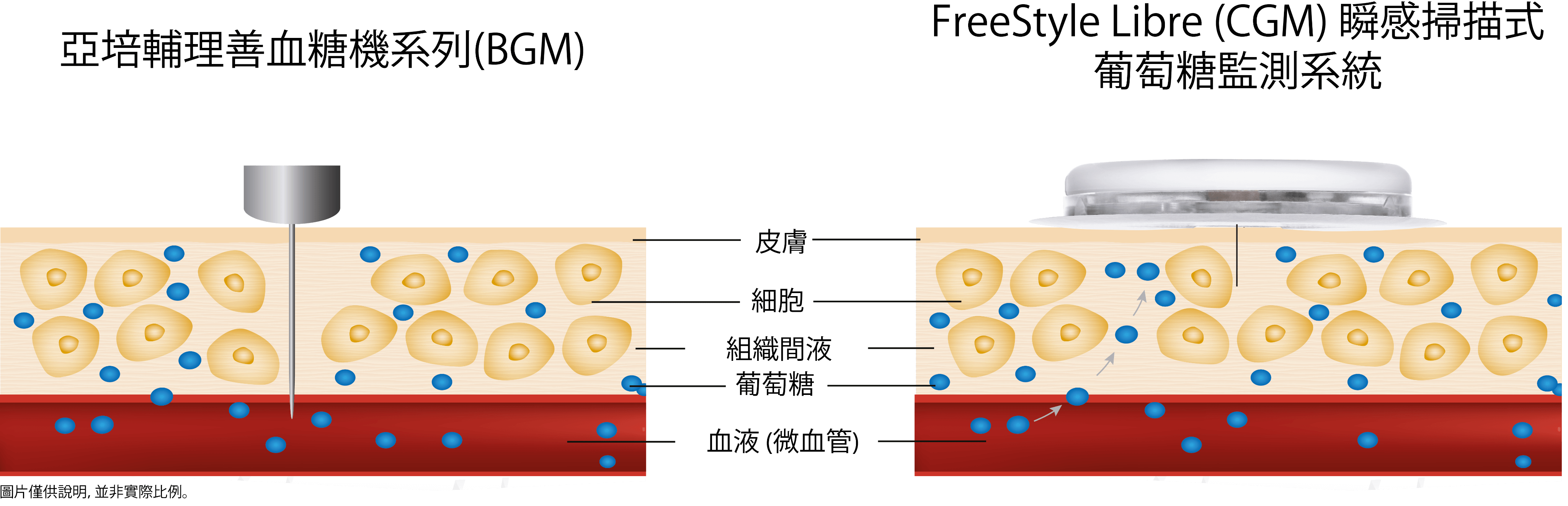 亞培輔理善血糖機系列 (BGM) 測量血液 vs FreeStyle Libre (CGM)