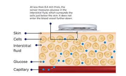 Glucose Diagram