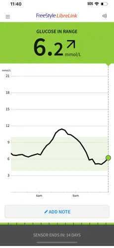 Phone screen showing a glucose reading of 6.2 mmol/L with a trend arrow going up