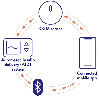 In an automated insulin delivery system, the mobile app is controlled by the sensor, which sends data to the AID system, which sends data back to the mobile app