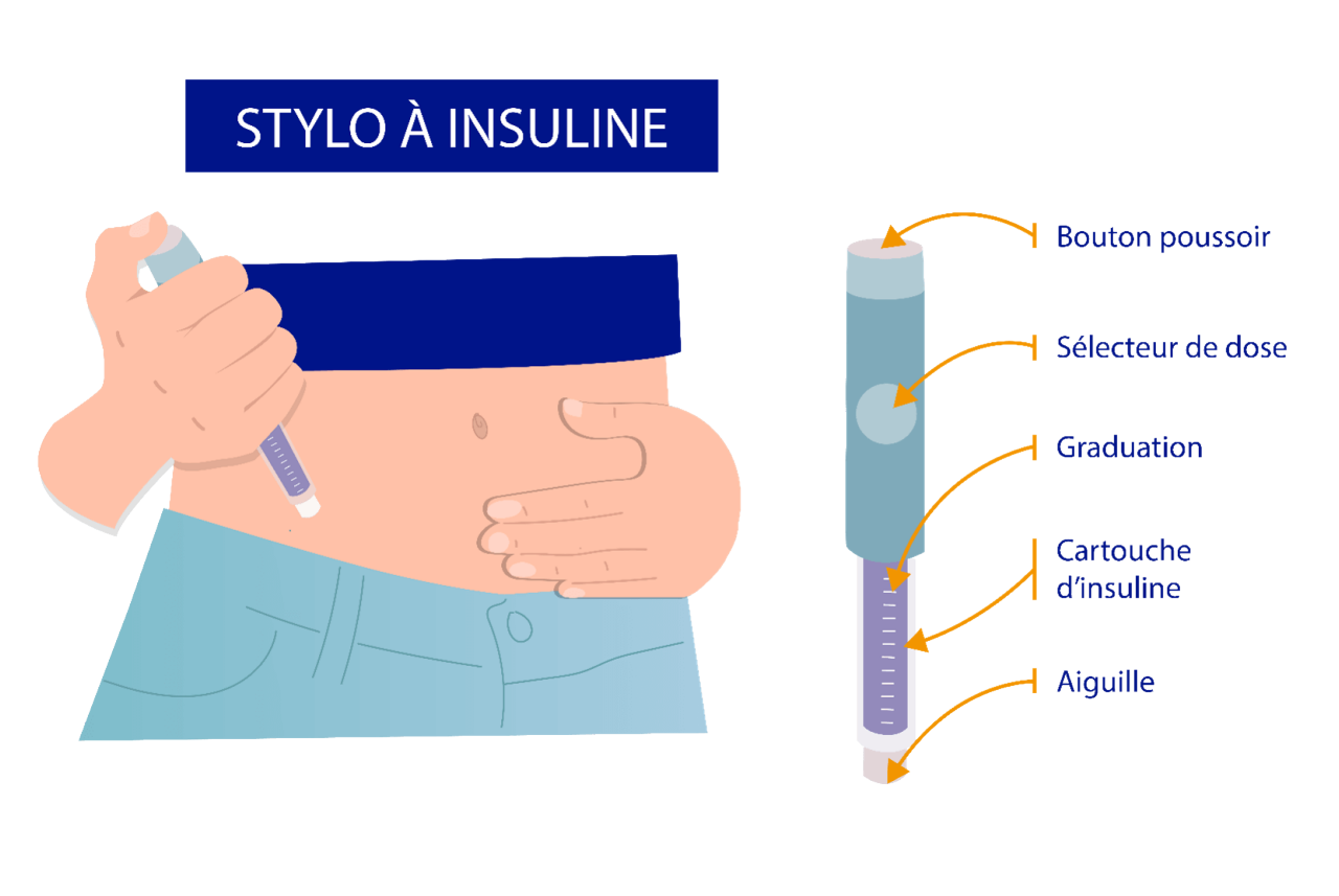 Les stylos à insuline jetable ou non (qui ont largement remplacé les anciennes seringues