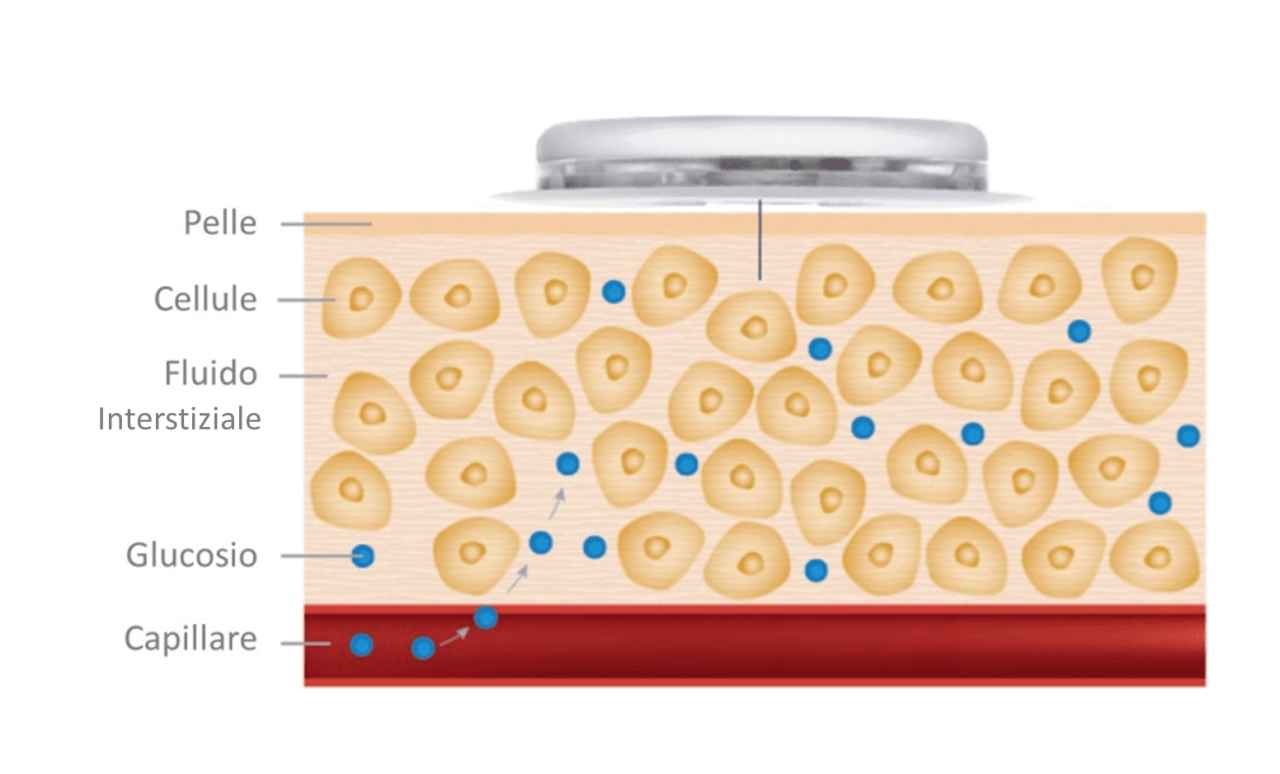 Rappresentazione schematica di glucosio capillare e glucosio interstiziale