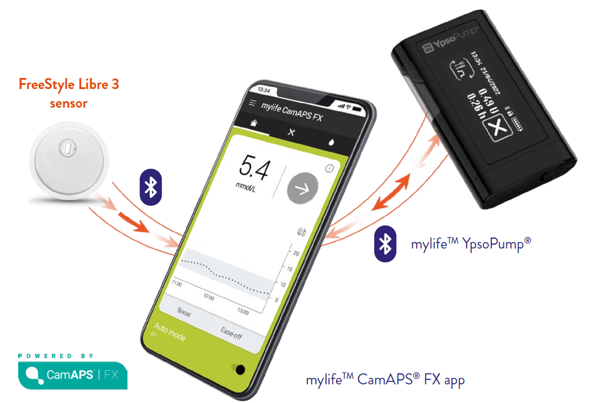 mylife loop systeem