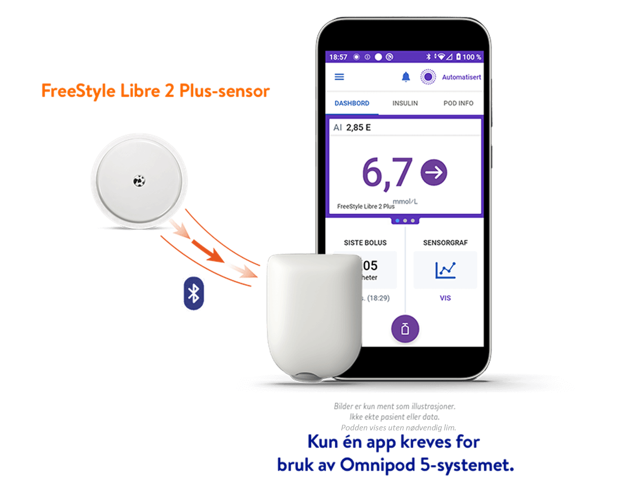FreeStyle Libre 2 plus-sensorn med Omnipod 5-systemet