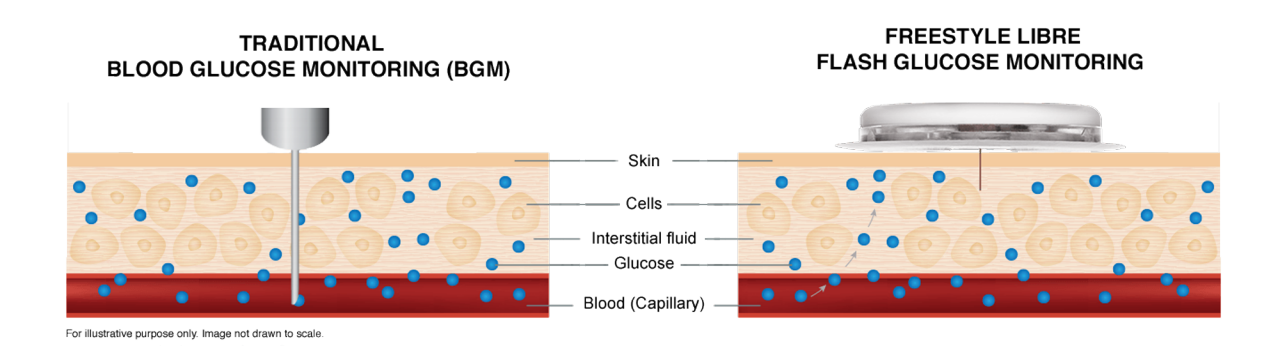 BGM-VS-ISF