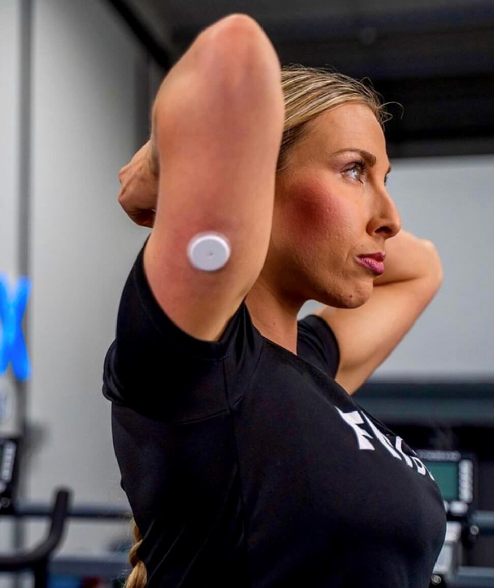 Women with FreeStyle Libre 2  Sensor 