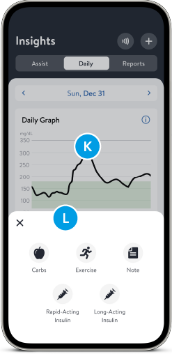 Glucose trends and insights
